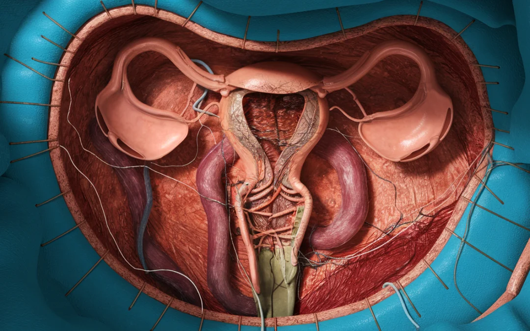 Histerectomía abdominal: Todo lo que necesitas saber sobre este procedimiento